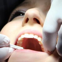 Bào chế thành công thực phẩm chức năng ngăn ngừa bệnh răng miệng