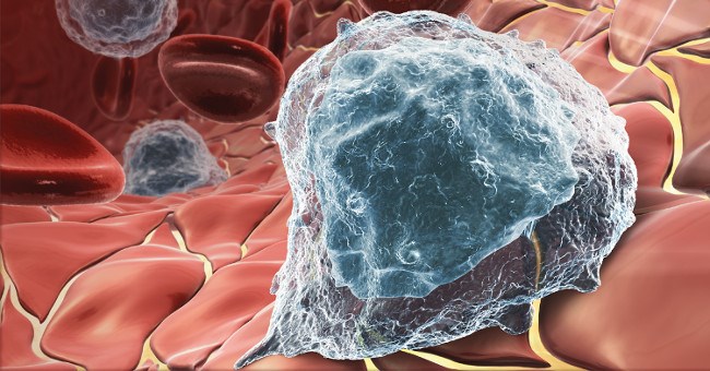 Thử nghiệm thành công vaccine chống ung thư - 12 người khỏi bệnh