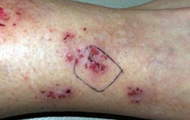 Nghi vấn những căn bệnh có nguồn gốc… ngoài hành tinh