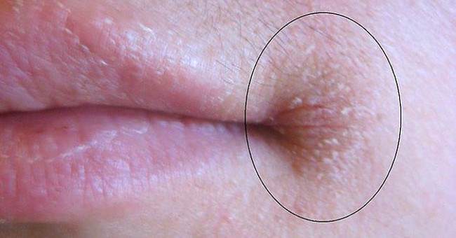 Nhìn vào mép và thấy thứ này, đó là dấu hiệu cơ thể bạn đang "báo động"