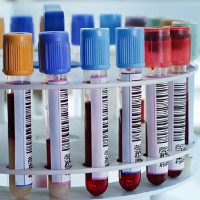 SoftBank và nhiều công ty khác đầu tư tiền tỉ vào công nghệ xét nghiệm ung thư bằng máu