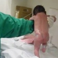 Các bác sĩ giải thích hiện tượng em bé vừa sinh ra đã bước đi