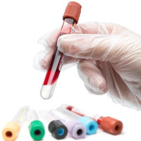 Xét nghiệm máu có thể biết được những bệnh gì?