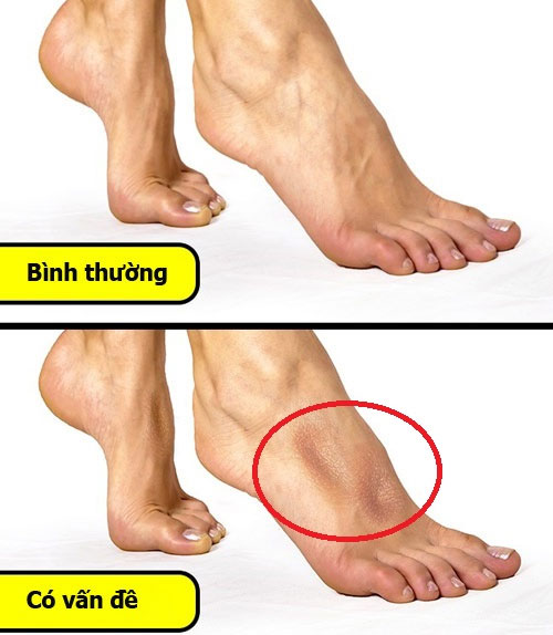 Các mẹo kiểm tra sức khỏe cực đơn giản