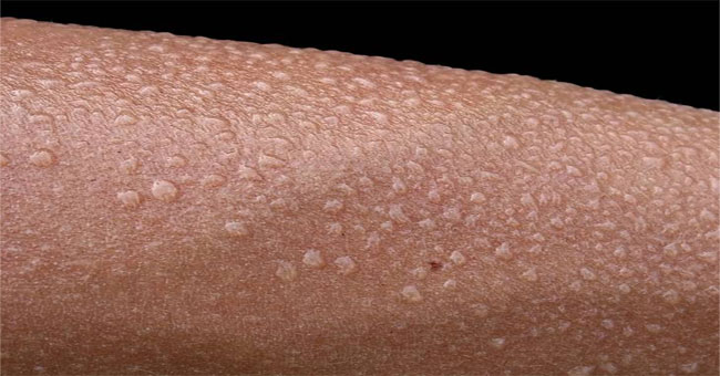 Miếng dán biến mồ hôi thành nguồn sạc cho điện thoại