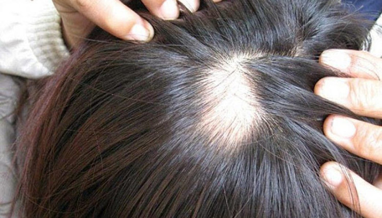 Bạn sẽ không còn lạm dụng dùng dầu gội khô nữa sau khi đọc bài viết này