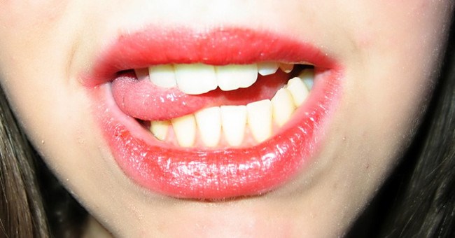 Khoang miệng nhiều vi khuẩn nhưng sao vết thương cắn vào lưỡi lại không bị nhiễm trùng?