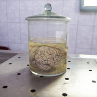 Quân đội Mỹ đầu tư 65 triệu USD để nghiên cứu cấy ghép não