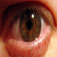 Phát hiện sốc: Trong mắt tồn tại 1 cộng đồng vi khuẩn