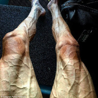 Lý do khiến chân của vận động viên đua xe đạp biến dạng khủng khiếp
