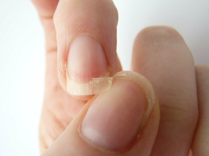 Móng tay dễ gãy: 6 nguyên nhân thường gặp và cách khắc phục nhanh chóng