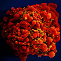 Ca nhiễm virus HIV được chữa khỏi thứ 3 trên thế giới