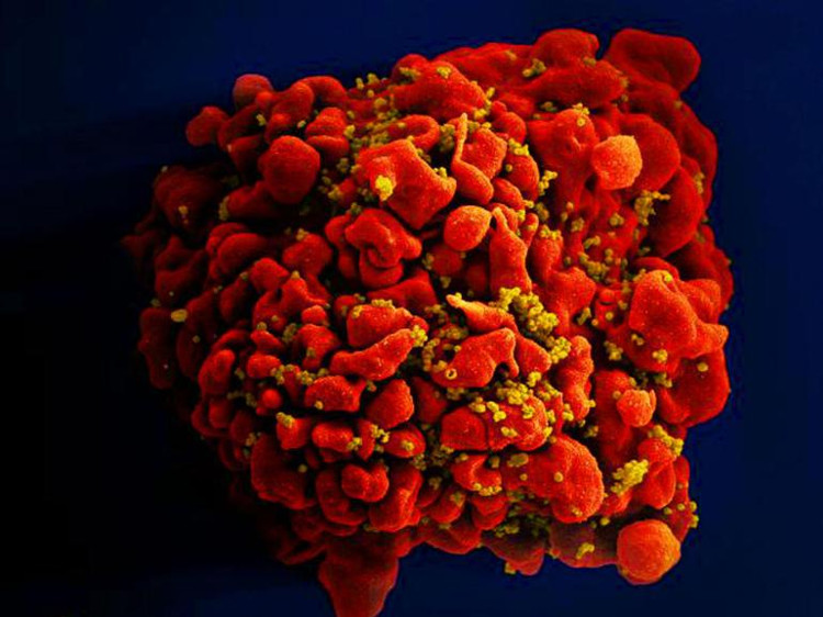 Ca nhiễm virus HIV được chữa khỏi thứ 3 trên thế giới