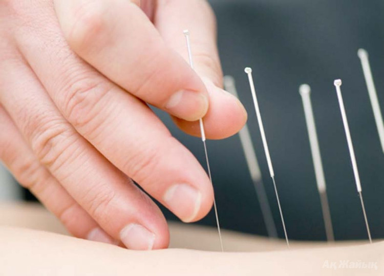 Thủy châm, phương pháp châm cứu tiêm thuốc chữa nhiều bệnh