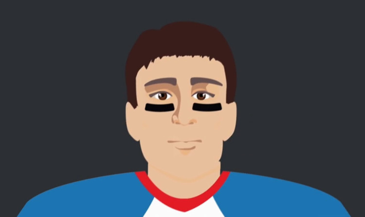 Viền đen dưới mắt.