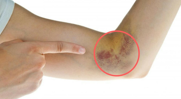Những biểu hiện sớm của bệnh tiểu đường mà bạn nên đề phòng