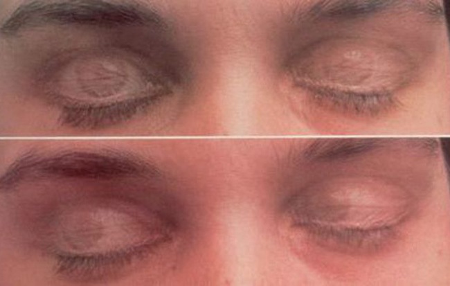 Vì sao chúng ta lại nhắm mắt khi ngủ - câu hỏi tưởng đơn giản mà giới khoa học cũng 
