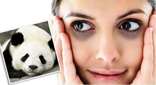 Tại sao thức khuya mắt hay bị thâm quầng?