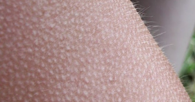 Bí mật về một bộ phận duy nhất trên cơ thể không bao giờ “nổi da gà”