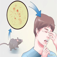 Mắc bệnh sodoku vì bị chuột cắn