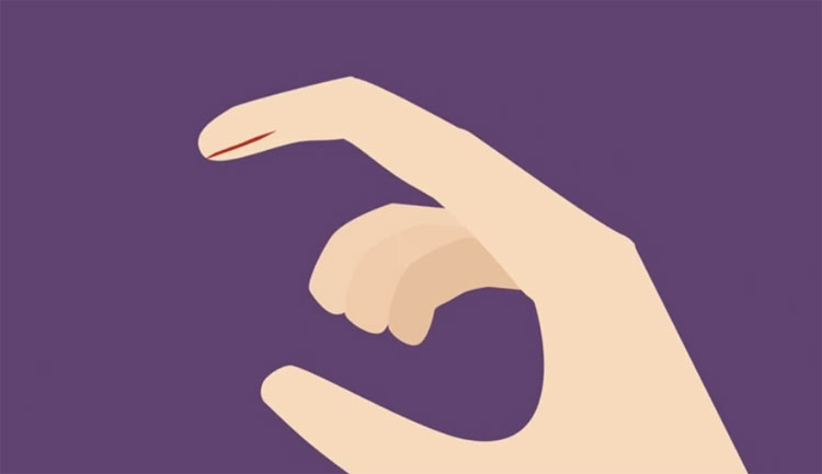 Chất hóa học và vụn gỗ ở giấy bám vào vết thương khiến đứt tay do giấy thường đau hơn.