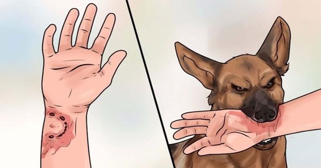 Vì sao chỉ từ 1 vết cắn mà có thể gây nhiễm trùng máu lấy đi mạng người?