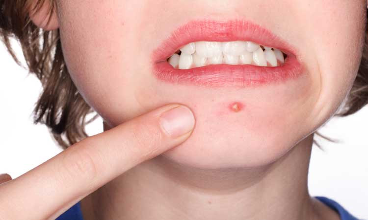 6 dấu hiệu cho thấy bạn đã không ăn đủ lượng rau củ quả cần thiết