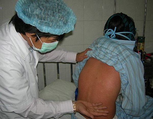 6 bệnh dễ bùng phát trong mùa đông - xuân