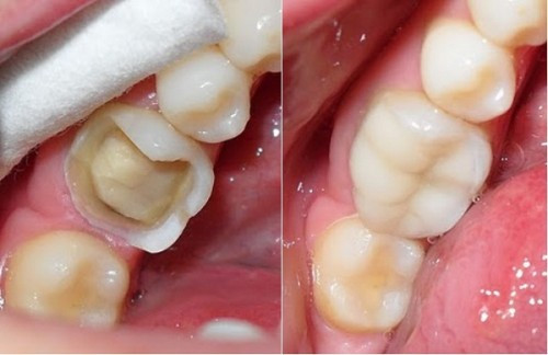 Những thói quen hàng ngày khiến tuổi thọ của bạn rút ngắn nghiêm trọng