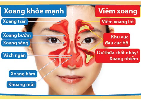 Cách phòng tránh viêm mũi dị ứng mùa lạnh ẩm