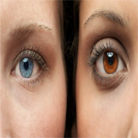 Sau 20 giây chiếu laser, màu mắt sẽ đổi từ nâu sang xanh vĩnh viễn
