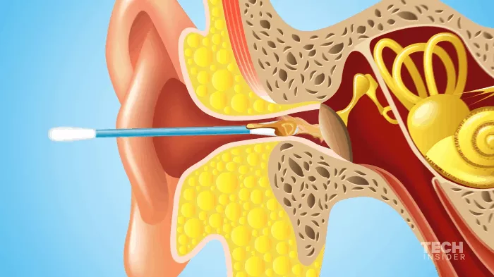 Đây là nhóm người duy nhất có thể dùng tăm bông để ngoáy tai