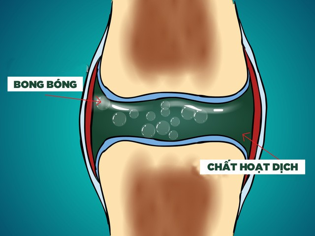 Chuyên gia tự bẻ khớp tay suốt 60 năm liền chỉ để chứng minh một điều nho nhỏ