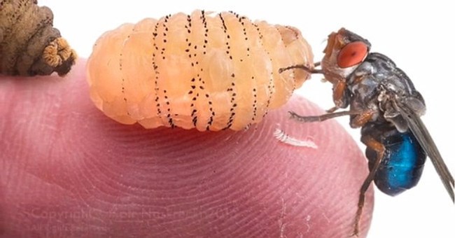 Video: Cận cảnh màn gắp ấu trùng ruồi trâu kinh dị trên vai cô gái thu hút triệu người xem