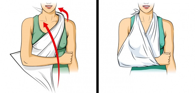 Kỹ năng sống cứu cuộc đời bạn trong tình huống bất ngờ