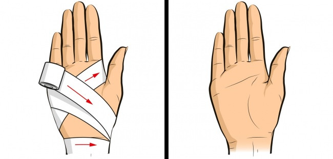 Kỹ năng sống cứu cuộc đời bạn trong tình huống bất ngờ