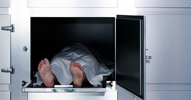 Hội chứng khiến các bác sĩ suýt khám nghiệm tử thi người sống