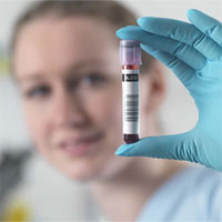 Cách thử máu mới giúp phát hiện 8 loại ung thư