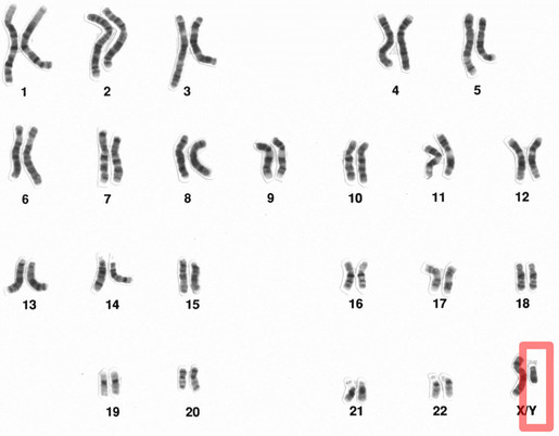 Thế giới sẽ không còn đàn ông?