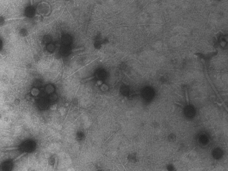 Hàng tỉ con virus đang rơi vào đầu chúng ta mỗi ngày mà chẳng ai hay biết