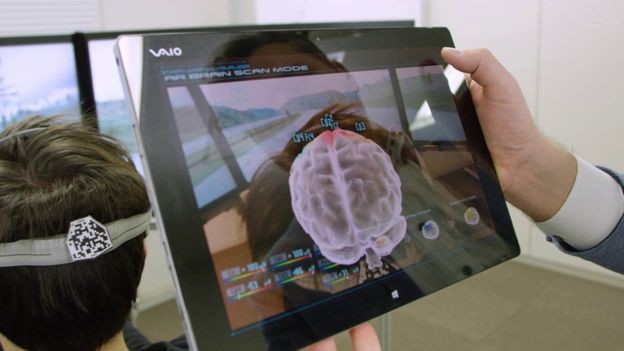 BCI (Brain Computer Interface): tương lai điều khiển máy móc bằng ý nghĩ