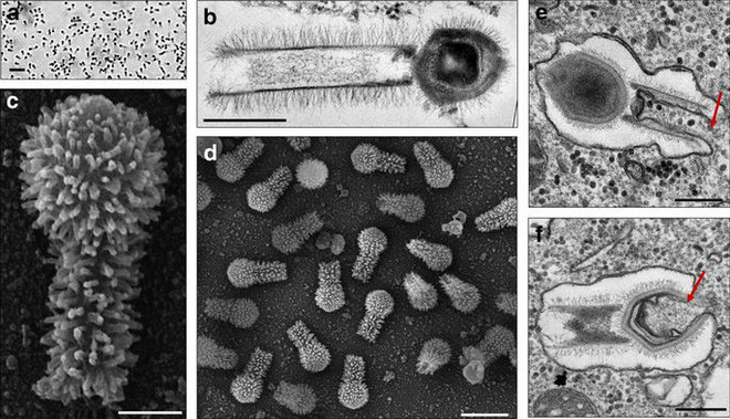Virus khổng lồ mới được phát hiện có thể thay đổi định nghĩa của chúng ta về virus