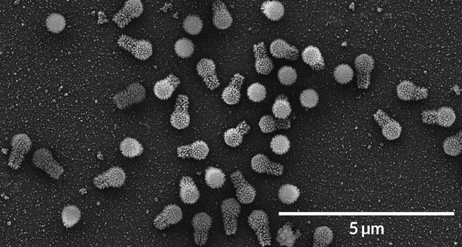 Virus khổng lồ mới được phát hiện có thể thay đổi định nghĩa của chúng ta về virus