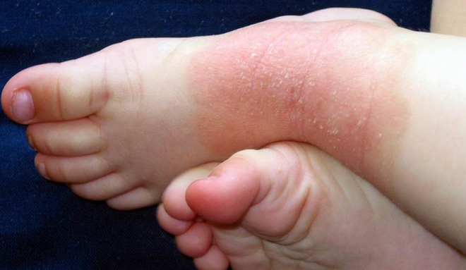 Giải mã 8 quan niệm sai lầm mọi người thường nghĩ về vắc-xin