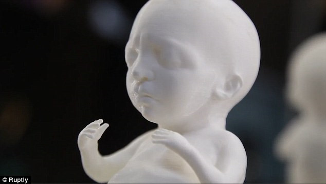Công nghệ mới giúp bậc cha mẹ có được mô hình 3D của thai nhi