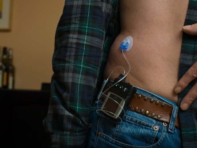 Lịch sử gần 100 của insulin - nguồn sống của những người bệnh tiểu đường