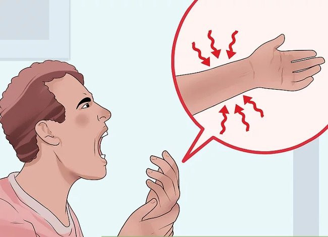 Phân biệt giữa bong gân cổ tay và gãy xương cổ tay