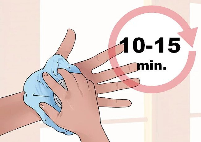 Phân biệt giữa bong gân cổ tay và gãy xương cổ tay