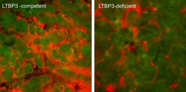 Các nhà khoa học tìm ra protein có thể ngăn ngừa ung thư di căn