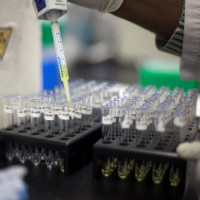 Nhật thử nghiệm phương pháp xét nghiệm nước tiểu phát hiện ung thư